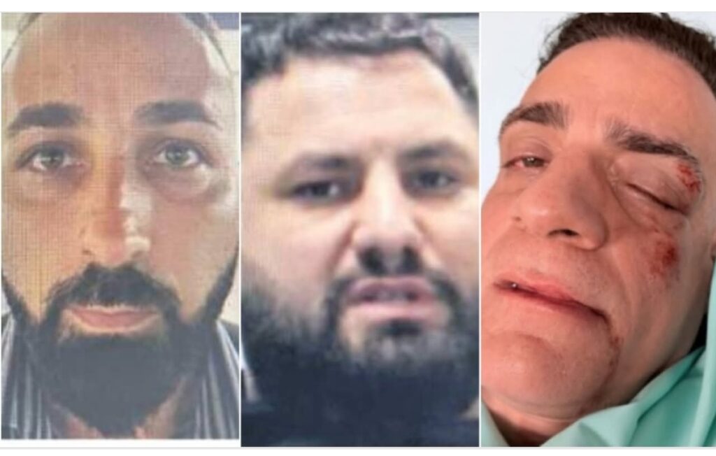 Celebrul YouTuber italian Simone Cicalone, bătut de doi români. Agresorii au fost identificați, dar ar fi fugit din Italia